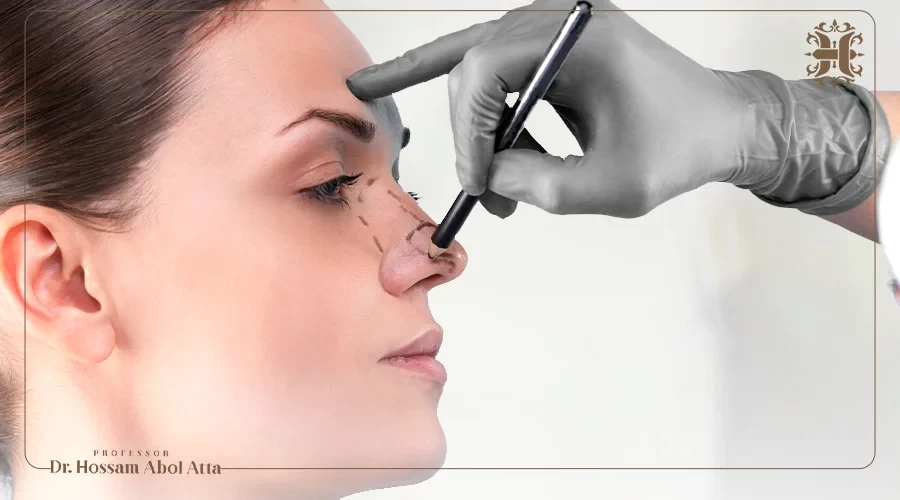 اسعار عمليات تجميل الانف في مصر